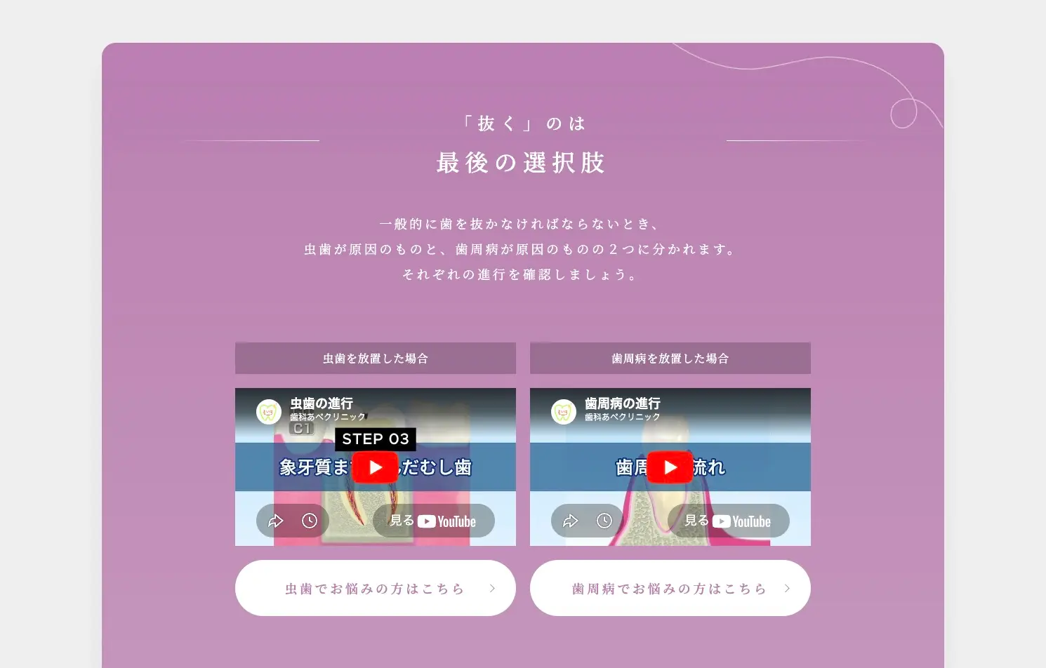 「抜く」のは最後の選択肢