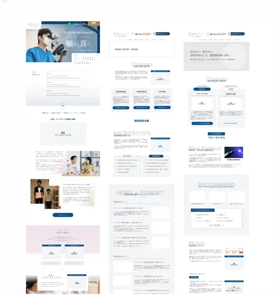 ワイヤーフレーム_インプラントサイト